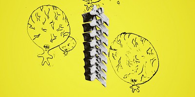 I Shall Escape by Dawn -Episode II